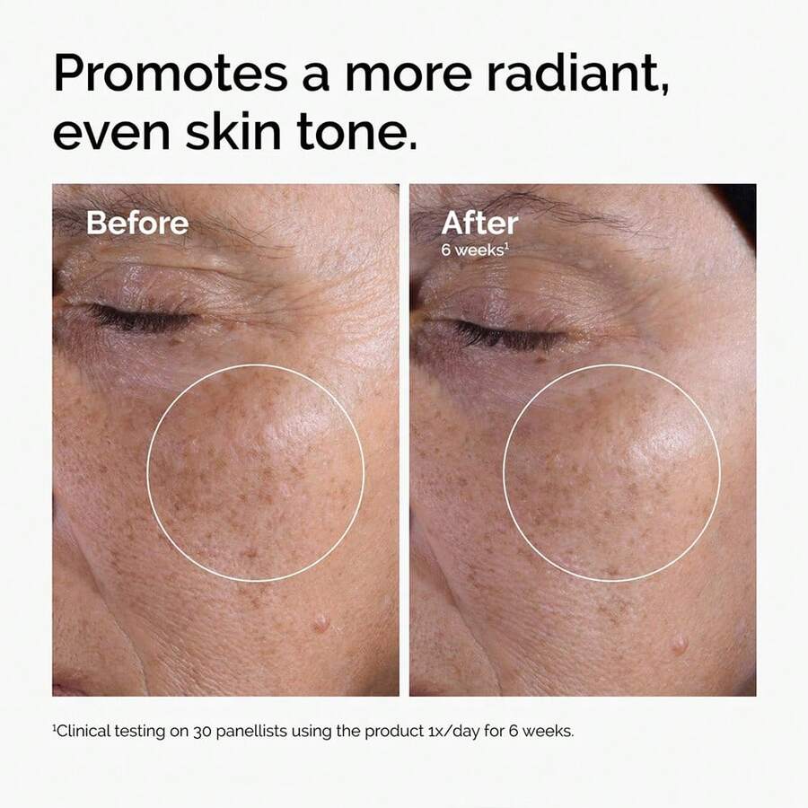 The Ordinary Glycolic Acid 7% Exfoliating Toner, Brightening And Smoothing Daily Toner For More Even-Looking Skin Tone
