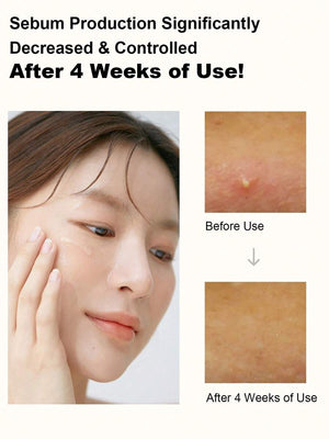 ANUA Rice 70 Luminous Cream Toner, Suitable For Glassy Skin And Brightening, Rice Water, Niacinamide, Ceramide, Panthenol, Fragrance-Free, Non-Comedogenic, Korean Skin Care 250ml