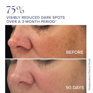 iS CLINICAL Brightening Complex, Skin Brightening Complex, Addresses Age Spots