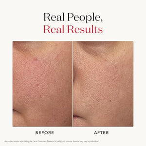 Facial Treatment Essence - Anti-Aging Essence Skincare to Help Reduce the Appearance of Fine Lines & Wrinkles - Visibly Refines Texture & Improves Firmness & Dark Spots