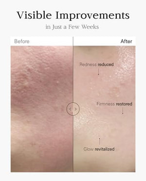 Nuborn Cell Placenta Stem Cell Intensive Repair Cream | Dragon Blood Cream with Placental Extract | Collagen Korean Skin Care for Glass Skin (50ml)