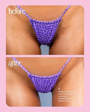 Truly Cooka Collection | Soothing & Hydrating Treatment for Sensitive Areas | Prevents Irritation and Ingrown Hair in Bikini Line & Intimate Areas