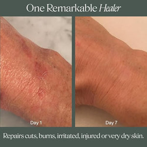Doctor Rogers Healing Balm, Hydrating Multi-Use Healing Ointment, Protects and Soothes Dry, Injured, Sensitive Skin, Hypoallergenic, 4oz (114g)