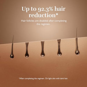 Silk'n 7 IPL Laser Hair Removal Device for Women and Men with Rotating Head, Painless Permanent Hair Reduction at Home for Face and Body in 7 Mins, 3 Smart Attachments and Automatic Skin Sensor, Gold