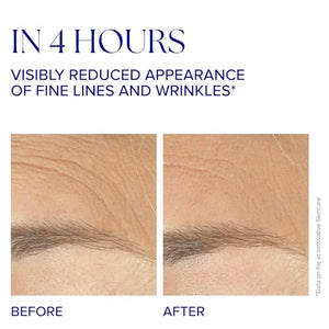 IS CLINICAL Youth Complex, An Anti-aging, Formula Boosts Collagen and Elastin Production Anti-wrinkle and Firms Skin