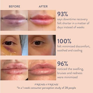 Aesthetic Aftercare | TAKE After CARE Arnica & Bromelain Gel for Bruising, Swelling after Fillers, Cosmetic Injections | Cooling Depuff Serum Face Roller | 100% Vegan (30ml)