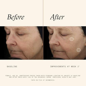 SkinMedica TNS Advanced+ Face Serum - Multi Peptide Serum to Help Improve the Appearance of Wrinkles, Fine Lines, Skin Tone & Texture (1 oz)