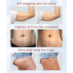 MLAY Professional RF Beauty Machine, Radio Frequency Face Machine with 2 Probes, at Home Radio Frequency Skin Tightening for Lifting, Wrinkle Reducing, Anti Aging - Salon Effects（Gel Included）