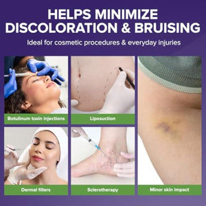 BIOCORNEUM Advanced Bruise Dietary Supplement – Internal Support for Visible Bruise Recovery – Professional Bruise Remedy with Arnica, Vitamins K1, K2, C, Zinc & Bromelain for Bruising and Swelling