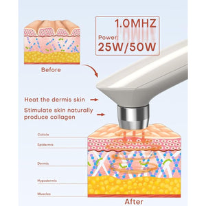 MLAY Professional RF Beauty Machine, Radio Frequency Face Machine with 2 Probes, at Home Radio Frequency Skin Tightening for Lifting, Wrinkle Reducing, Anti Aging - Salon Effects（Gel Included）