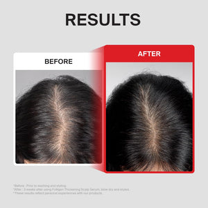 Dr.FORHAIR Folligen Thickening Scalp Serum 1.7 oz | Biotin Density Serum for Thicker, Fuller-Looking Hair | Peptide Scalp Treatment | Korean Haircare