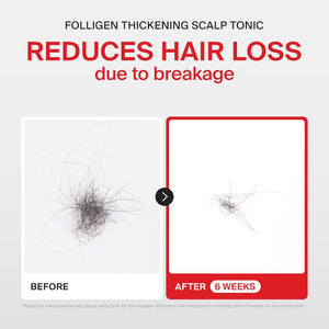 Dr.FORHAIR Folligen Tonic 4.06 fl oz | Scalp Serum for Hair Care | Scalp Care and Nourishment | Revitalizing Tonic for Healthy Scalp & Hair Thickening
