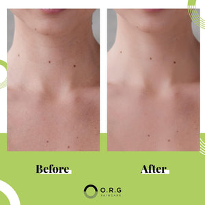 O.R.G Skincare Mineral Peel Body Exfoliator - K-Beauty Body Peel for Smooth, Glowing Skin - Gentle Non-Abrasive Exfoliating Formula for Sensitive Skin, Natural & Cruelty-Free, 6 ounces