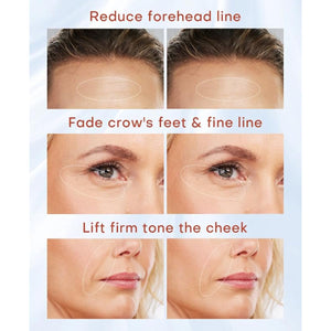 MLAY Professional RF Beauty Machine, Radio Frequency Face Machine with 2 Probes, at Home Radio Frequency Skin Tightening for Lifting, Wrinkle Reducing, Anti Aging - Salon Effects（Gel Included）
