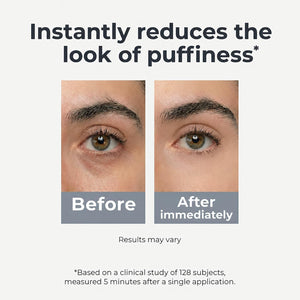 Under Eye Brightener Roller - Caffeine & Retinol Eye Serum for Dark Circles, Puffiness & Fine Lines, Travel Essential Vegan Skincare, Cooling Eye Massage, Dermatologist-Tested, 0.52 fl oz