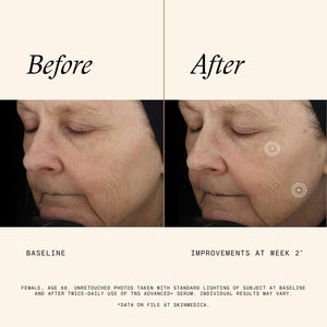 SkinMedica TNS Advanced+ Face Serum - Multi Peptide Serum to Help Improve the Appearance of Wrinkles, Fine Lines, Skin Tone & Texture (1 oz)