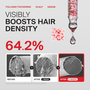 Dr.FORHAIR Folligen Thickening Scalp Serum 1.7 oz | Biotin Density Serum for Thicker, Fuller-Looking Hair | Peptide Scalp Treatment | Korean Haircare