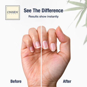Onsen Secret Complete Nail Reboot Kit w/Cuticle Oil 10ml, Nail File 120/180 Grit Double Sided, A 3-Way Buffer Block & Cuticle Serum-15ml in Action | Super Value Pack