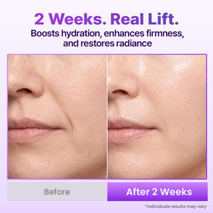 BIOHEAL BOH Probioderm 3D Lifting Cream Mist 3.38 fl oz | Korean Face Mist with Cream-Like Hydration for Instant Glow, Firm-Looking Skin & On-the-Go Refresh