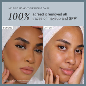 Alpha-H Melting Moment Cleansing Balm - Makeup & SPF Remover (90g) | Melts Away SPF, Dirt & Pollution, Nourishing Balm-To-Oil Texture, Vegan & Pregnancy-Safe for All Skin, Australian Made