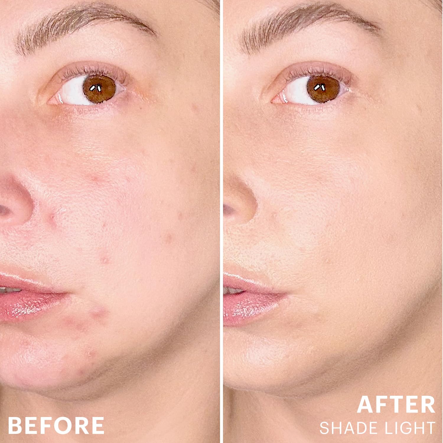 Glo Skin Beauty Spot Treat Concealer, Salicylic Acid, Light | Acne-fighting concealer, salicylic acid, full coverage for blemishes, long-wearing, color corrects dark spots, oily skin