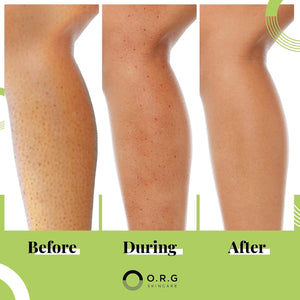 O.R.G Skincare Mineral Peel Body Exfoliator - K-Beauty Body Peel for Smooth, Glowing Skin - Gentle Non-Abrasive Exfoliating Formula for Sensitive Skin, Natural & Cruelty-Free, 6 ounces