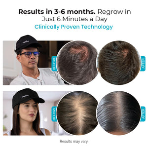 Capillus SPECTRUM Red Light Therapy Cap, Red Light Hat, 312 Laser Hair Growth Cap, Red Light Cap For Hair Regrowth, Near Infrared Red Light Therapy For Hair Growth, LLLT +Bluetooth Battery