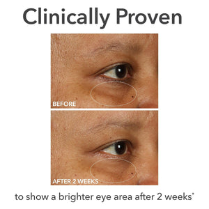 Dr Dennis Gross DermInfusions Fill + Repair Eye Cream: Hydrating & Brightening Treatment for Dark Circles, Fine Lines & Wrinkles, Firms & Smooths 360° Eye Area, 0.5 Oz