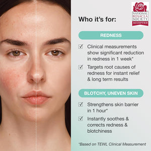 INNBEAUTY Project Calm The Red Down Dual Chamber Serum for Redness, Soothing & Skin Barrier Support, 1.7 OZ (50ml)
