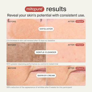 Timeline Mitopure Skincare Routine Starter Kit in Travel Case with Gentle Cleanser 50 ml, Resurfacing Exfoliator 30ml & Barrier Cream 15 ml for All Skin Types