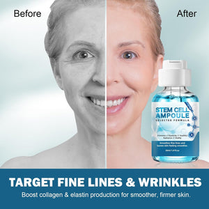 Botanical Stem Cell Ampoule for Face, Microneedling Serum, 2 Count | Hydrating facial serum ampoules for use with or without microneedling to improve the appearance of fine lines and dry skin