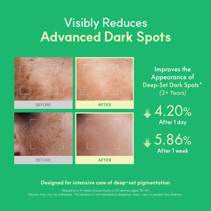 Easydew DW-EGF Melatoning Ampoule 5X - Hydrating Dark Spot Serum with Niacinamide & Glutathione for Uneven Skin - Fast Absorbing Day & Night Ampoule Korean Skin Care (Bottle 1.01 fl oz, EGF 5X)
