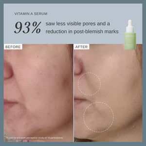 Alpha-H Face Serum - Daily Brightening For Dull, Uneven Complexion - Helps Boost Glow And Smooth Texture - Lightweight Comfort For Dry, Sensitive Skin