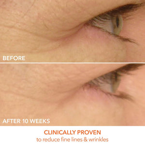Dr Dennis Gross DRx SpectraLite Eyecare Max Pro