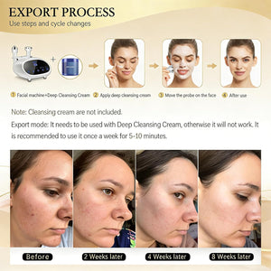 High Frequency RF Skin Tightening Device for Face & Body,Anti-Aging Beauty Machine for Wrinkle Reduction & Sagging Jawline, Non-Invasive At-Home Salon Facial Treatment for Women Model EP-400