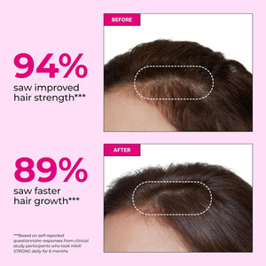 HUM Hair Strong Daily Hair Growth Gummies with Biotin, Zinc, Vitamin B12 to Support Growth, Folic Acid & Vitamin B12 Gummy Vitamins for Healthy Hair Support for Women and Men, 180 Gummies