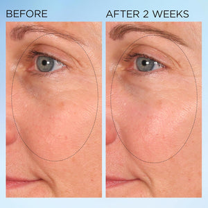 Elizabeth Arden Visible Brightening Clearly Radiant Spot Correcting Capsules