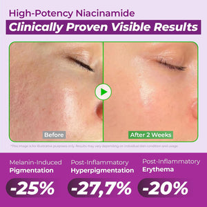 JUMISO 20% Niacinamide Dark Spot Serum 2-Pack, TXA + Glutathione, Korean | High-strength brightening for dark spots & uneven tone, Centella-soothed. Non-pilling water-gel; two 40ml bottles, vegan.