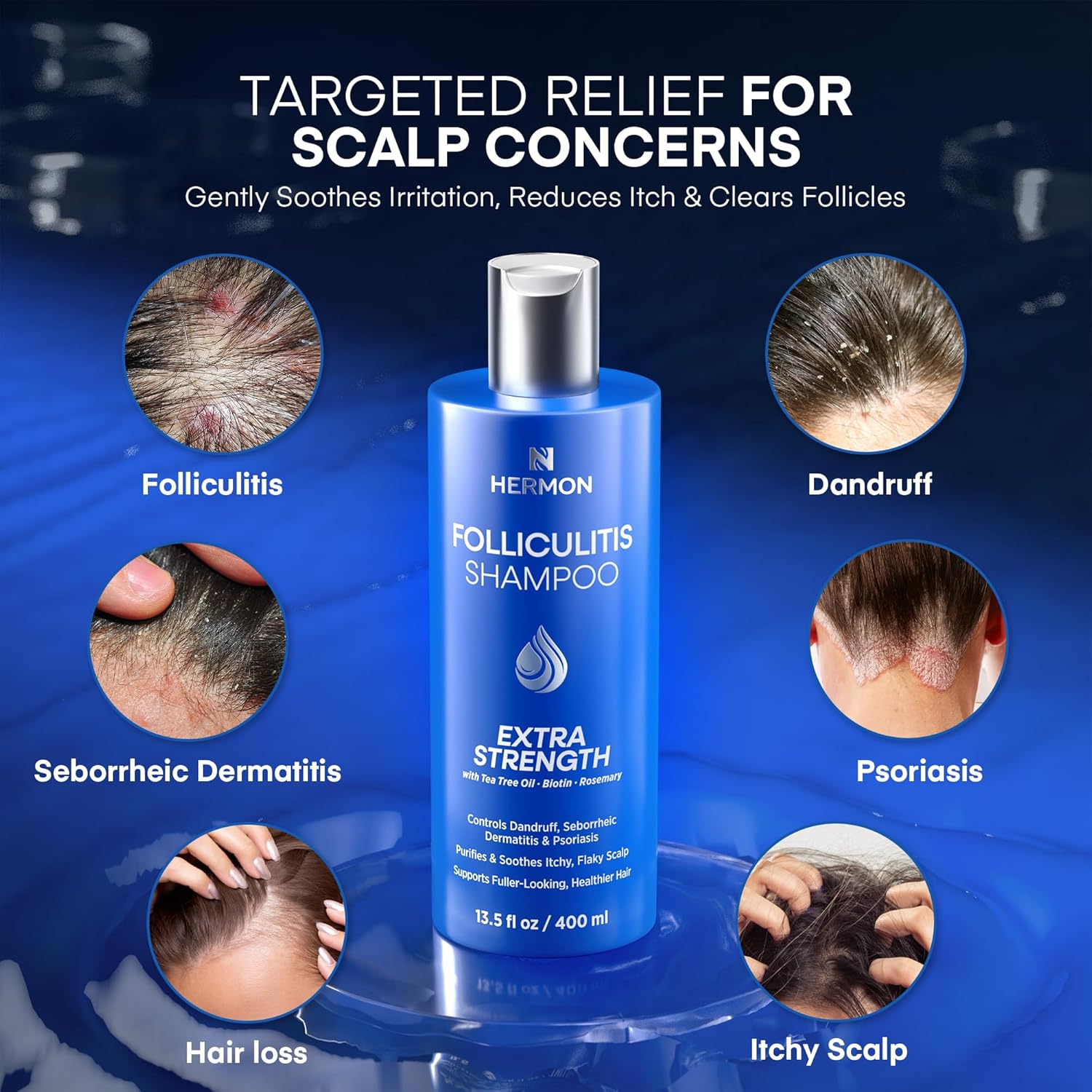 Hermon Folliculitis Shampoo for Itchy Scalp: Psoriasis, Dandruff & Seborrheic Dermatitis & Biotin – Soothes | Exfoliates | Reactivates Follicles 2 Packs