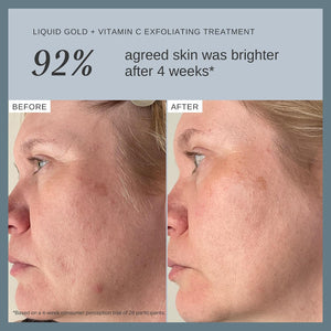 Alpha-H Liquid Gold Exfoliating Treatment 5% Glycolic Acid - Brighten, Even Tone, Smooth Texture, Reduce Appearance of Fine Lines - At-Home Skin Renewal for All Skin Types