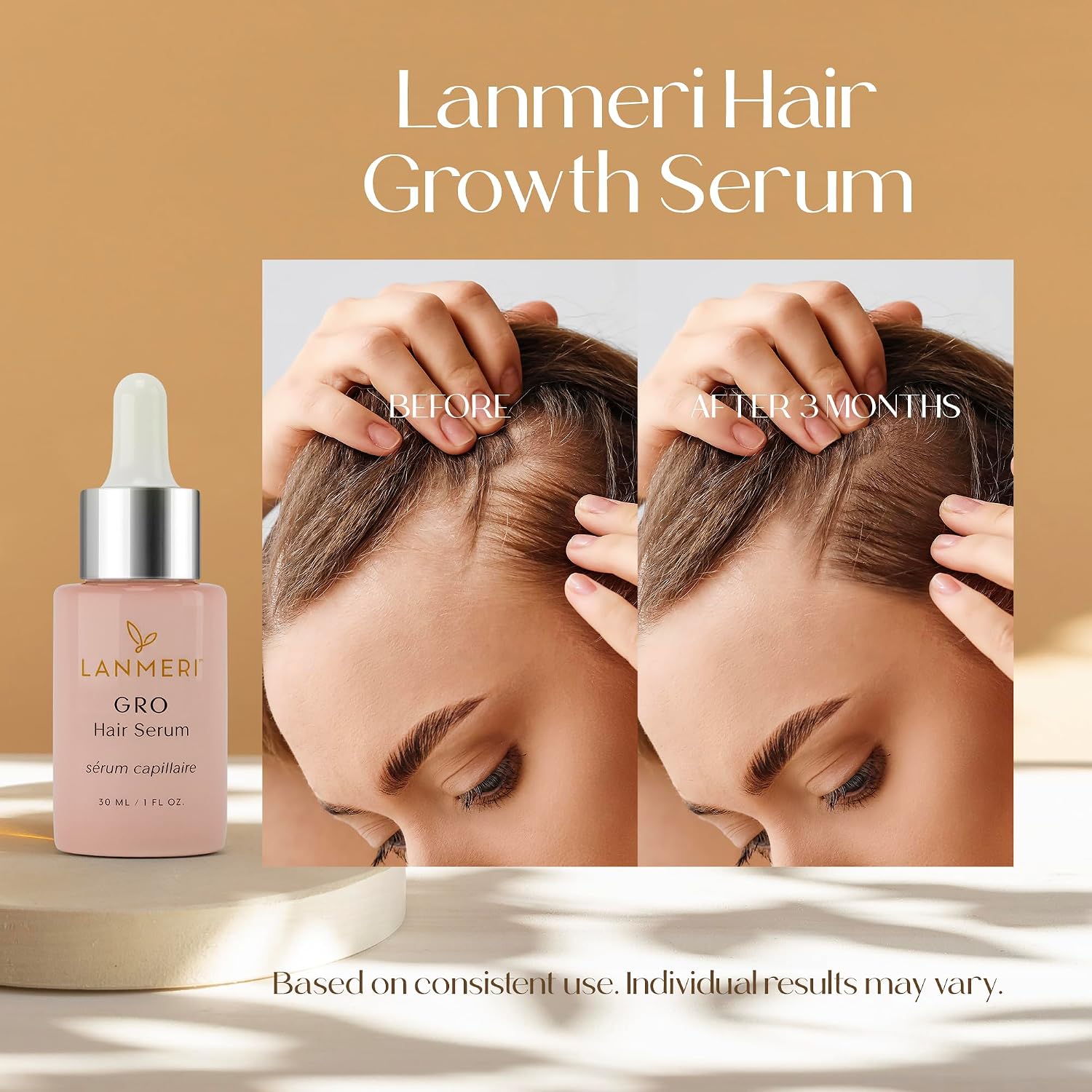 Vegan Hair Growth Serum - Natural Hair Regrowth and Hair Loss Treatments for Women & Men - Scalp Serum for Thinning Hair - Fuller, Thicker and Healthier Hair in 90 Days, All Hair Types