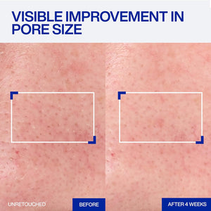 IOPE Expert Retinol RX 1% Super Bounce Serum - Gentle Anti-Aging Face Serum for Beginners - Visibly Firms Skin, Refines Pores, and Smooths Wrinkles