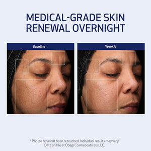 Obagi Medical Retinol + PHA Refining Night Cream - Clinically Proven, Dual-Action, Overnight Anti-Aging Face Cream for Smoother, Renewed Skin & a More Even-Looking Complexion - 1.7 Oz