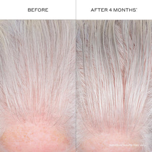 ZENAGEN Densifying Hair Serum for Fine + Thinning Hair | Boosts Hair Density, Strengthens & Nourishes Hair Follicles, Non-Greasy Water-Based Formula, Plant-Based, Vegan, All Hair Types