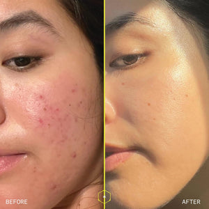 Aramore 1% Retinol Peptide Serum for Face with Collagen Peptides (30ml) | 1% Retinol & Collagen Peptides Visibly Reduce the Look of Wrinkles, Discoloration & Loss of Firmness, Patented Delivery