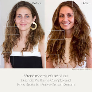 Root Replenish Active Growth Hair Serum with Redensyl DHT Blockers, Resveratrol & Scalp Microbiome Support for Thicker, Fuller-Looking Hair, Lightweight Water-Based Formula, 40mL