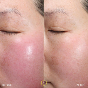 Aramore 1% Retinol Peptide Serum for Face with Collagen Peptides (30ml) | 1% Retinol & Collagen Peptides Visibly Reduce the Look of Wrinkles, Discoloration & Loss of Firmness, Patented Delivery