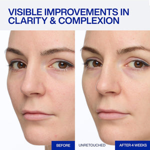 IOPE Expert Vitamin C 25% Antioxidant Serum - 25% Pure Vitamin C Face Serum - Visibly Evens Skin Tone, Enhances Radiance, and Smooths Texture – 5 Antioxidants and PHA - 0.77 fl. oz.