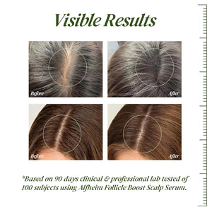 Saw Palmetto Follicle Boost Scalp Serum for Thinning Hair, Clinically Tested Hair & Scalp Treatment, Drug-Free Hormone-Free, Non-Greasy Formula with Peptides, Caffeine & Biotin