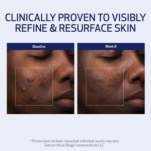 Obagi Medical Retinol + PHA Refining Night Cream - Clinically Proven, Dual-Action, Overnight Anti-Aging Face Cream for Smoother, Renewed Skin & a More Even-Looking Complexion - 1.7 Oz